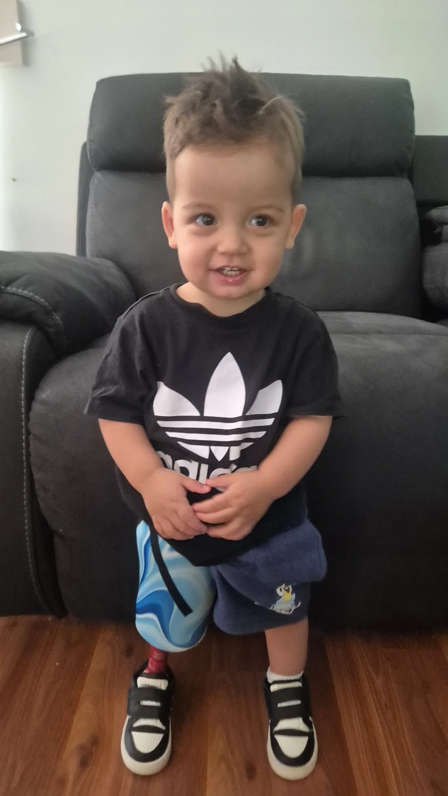Image of young boy wearing black t-shirt and wearing leg prosthetic