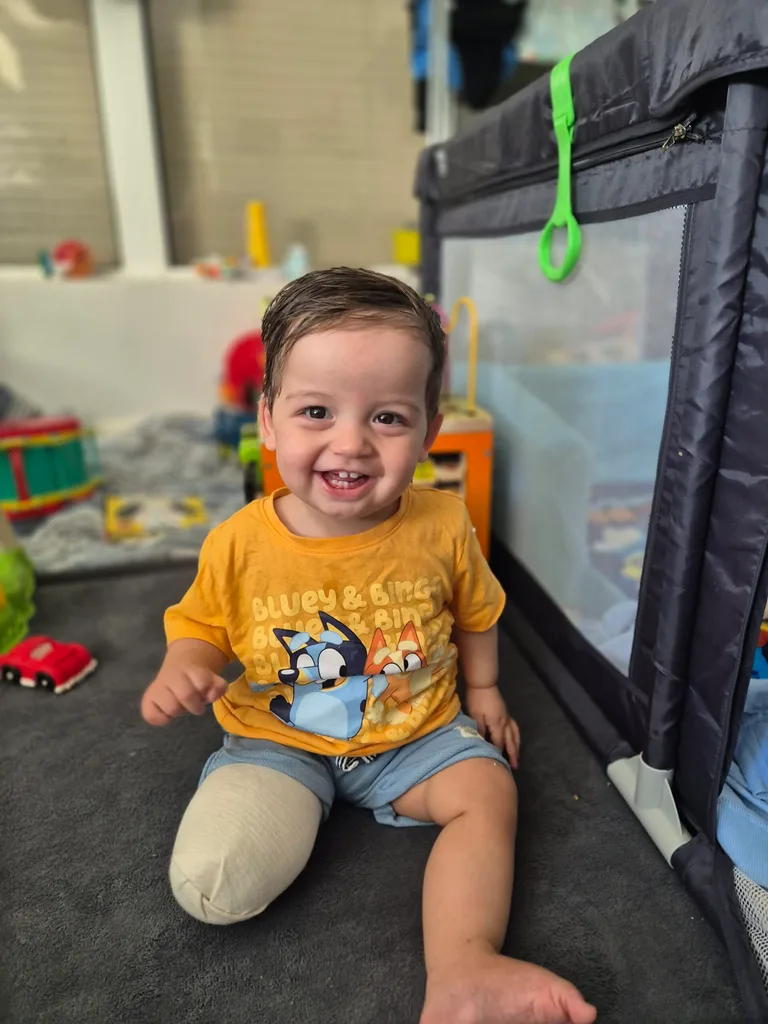 image of young boy wearing captain America theme top and showing his amputation