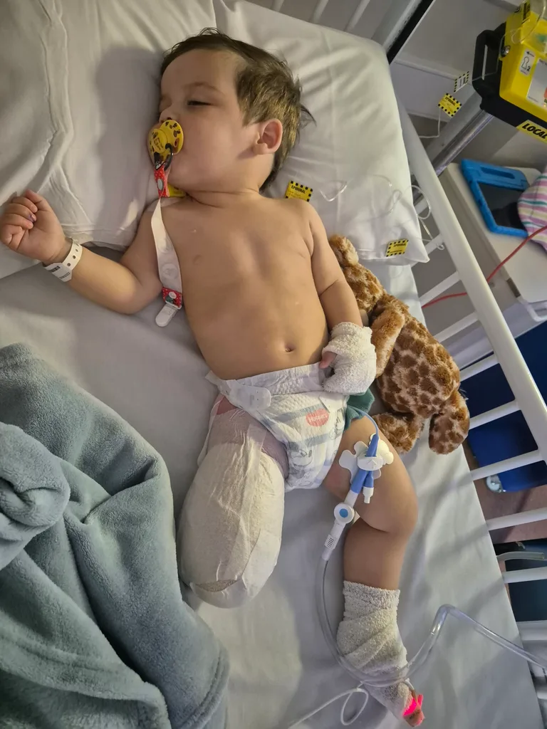 Image of young boy recovering from amputation surgery in hospital