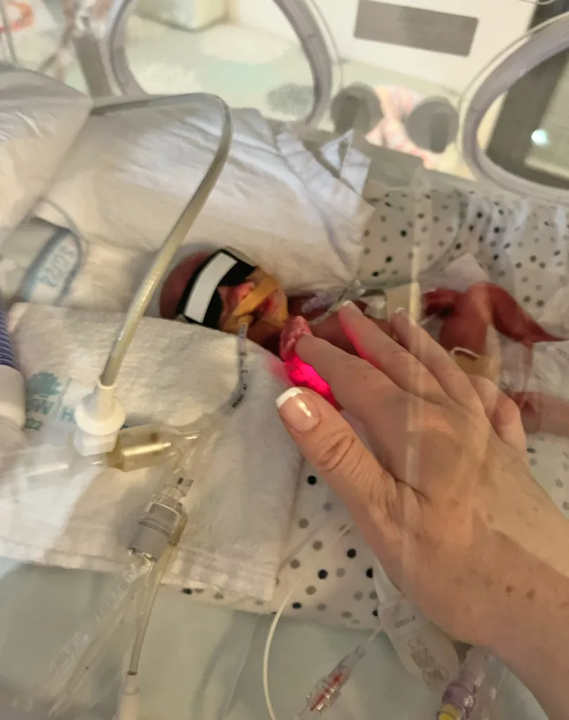 Image of premature baby in the NICU