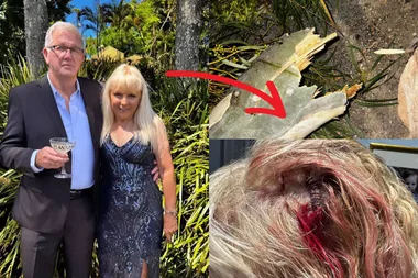 Marilyn and her husband before and after their freak accident. On the left they are standing outside dressed up in smart attire, and in the images on the right is the broken tree branch and Marilyn's head injury following the incident.