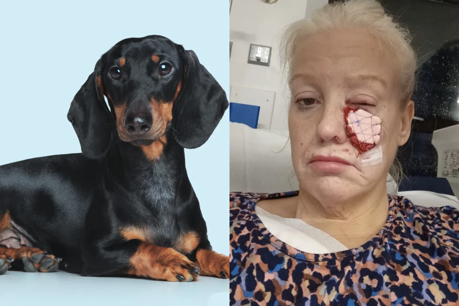 Image of black and tan sausage dog and image of blonde haired woman after sausage dog attack