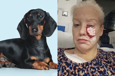 Image of black and tan sausage dog and image of blonde haired woman after sausage dog attack