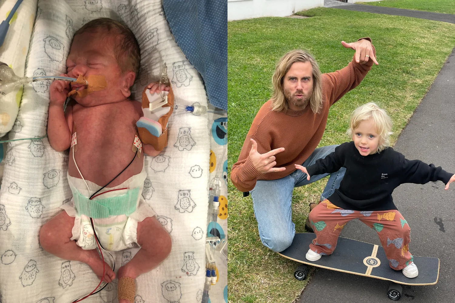 Image of prmature baby in the NICU and image of father and son learning how to skateboard