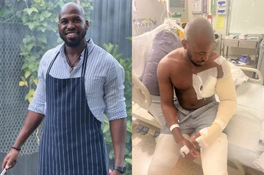 Image of man wearing chef apron and image of man wrapped in bandages in hospital