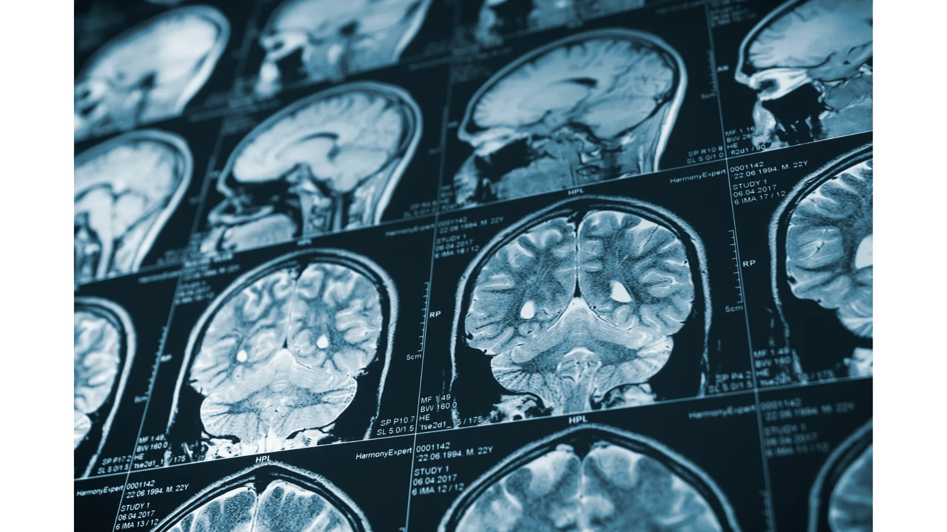 A series of brain scans are displayed.