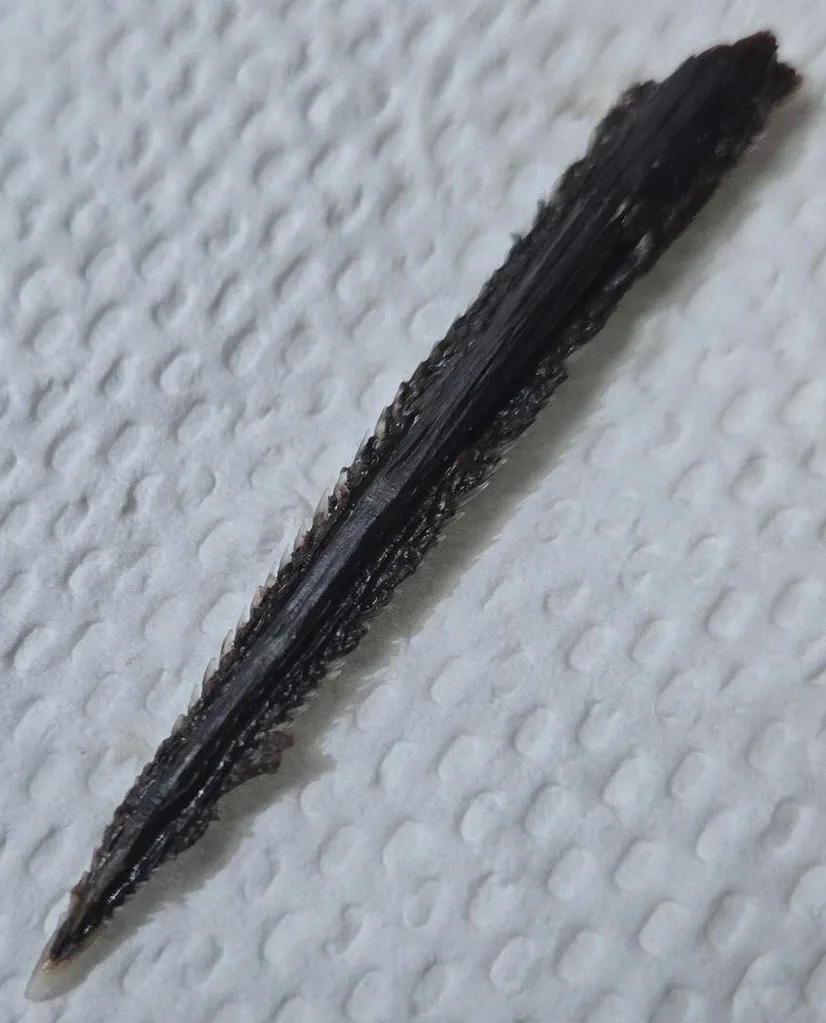 The 11cm long stingray barb removed from Eli’s upper thigh.