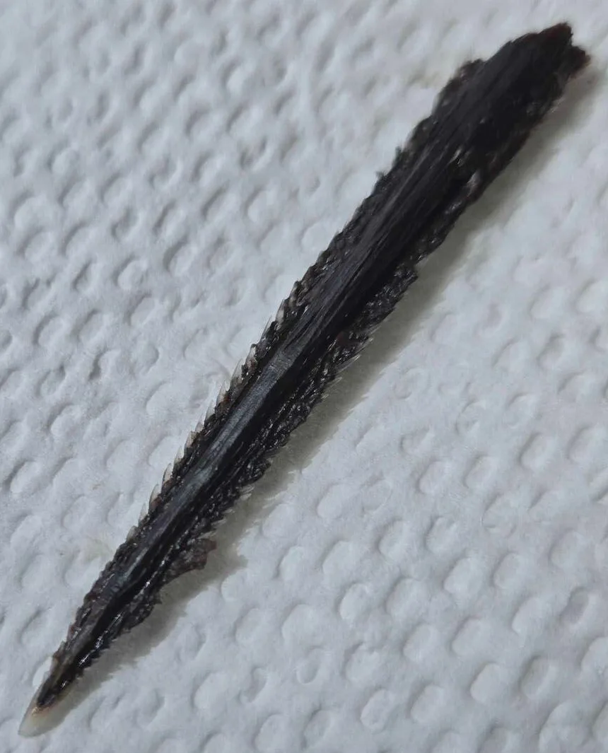 The 11cm long stingray barb removed from Eli&rsquo;s upper thigh.