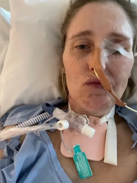 Woman in blue hospital gown and tubes out of her neck and from her nose in hospital laying on white pillow 