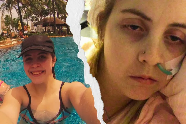 Holiday horror: I was paralysed by a worm living inside me