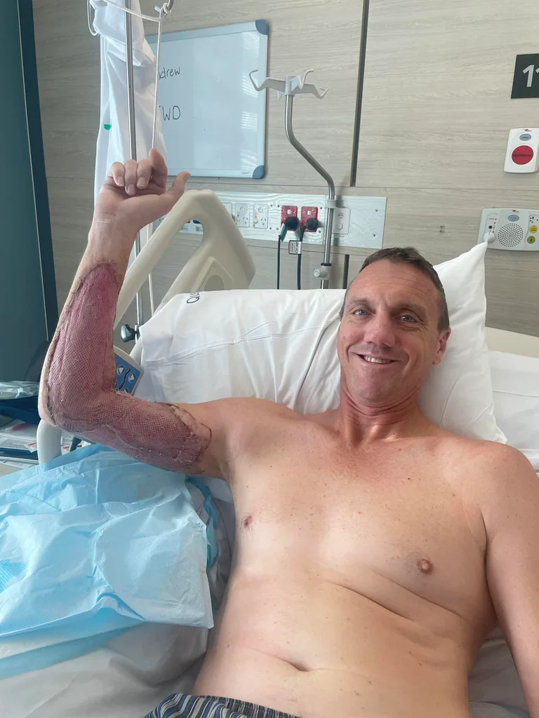 Man recovering from skin graft surgery in hospital
