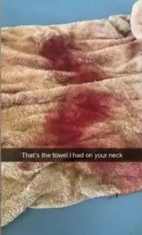 a white towel with red blood stains. There is text across the image saying 'that's the towel i had on your neck'