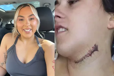 VB beer bottle horror: ‘It missed my jugular by millimetres’