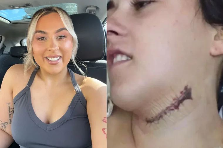 VB beer bottle horror: ‘It missed my jugular by millimetres’