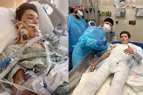 Holiday horror: My son’s skin melted off