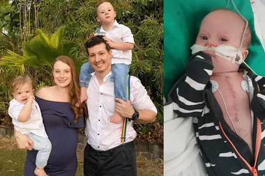 Oliver was born with a severe heart defect – now he’s thriving!