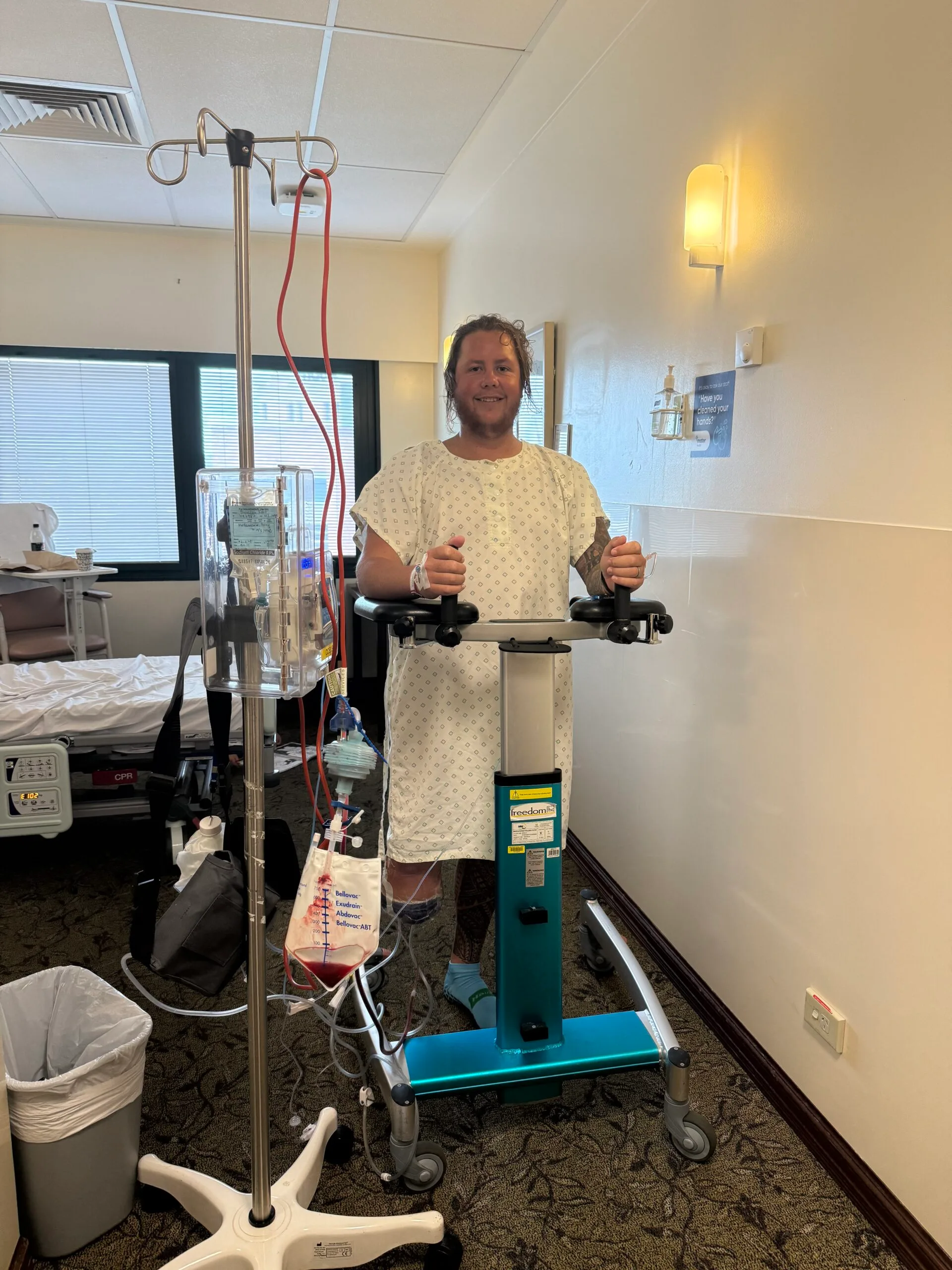 an in hospital with one leg