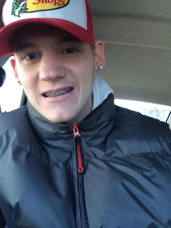 a young man in a puffer coat with braces