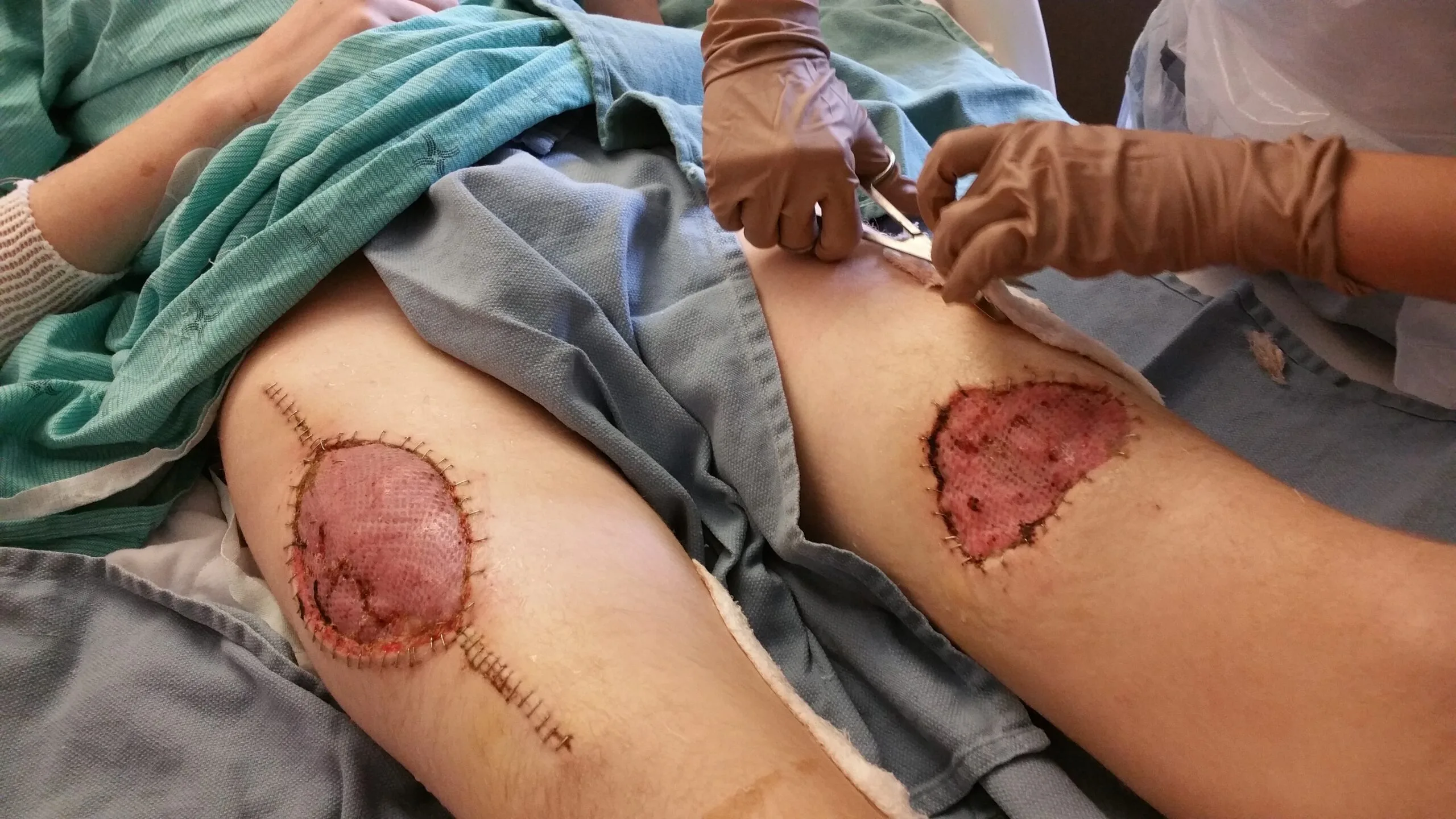 mans legs with red skin