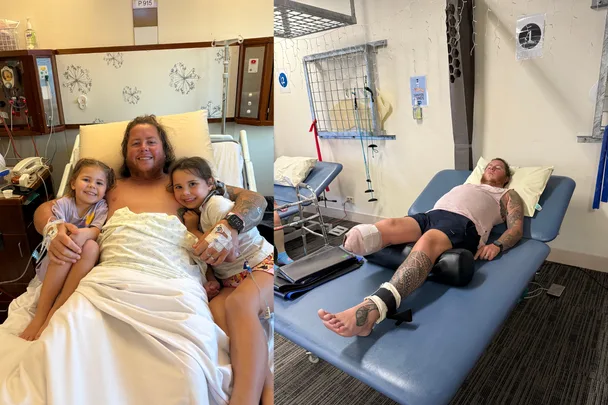 Aussie dad’s DIY disaster: ‘I fixed a leak and lost my leg’