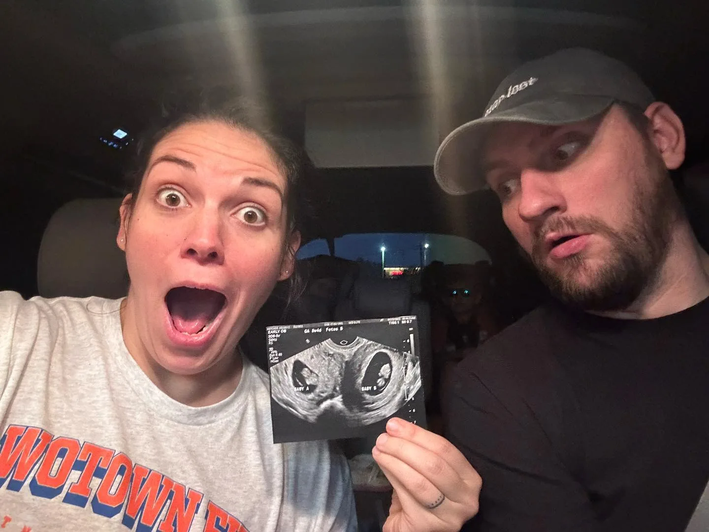 mother and father with ultrasound photo looking surprised 