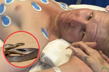 Rural contractor Braydon was bitten by an Eastern Brown snake twice in four years.
