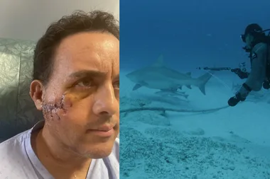 Shark bite horror: My head was inside the shark’s jaws