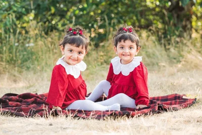 Image of twin girls post separation surgery