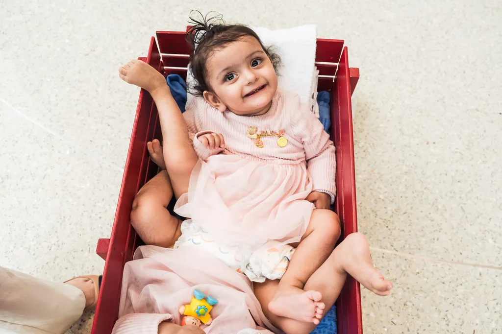 Image of twin girls conjoined at the hip