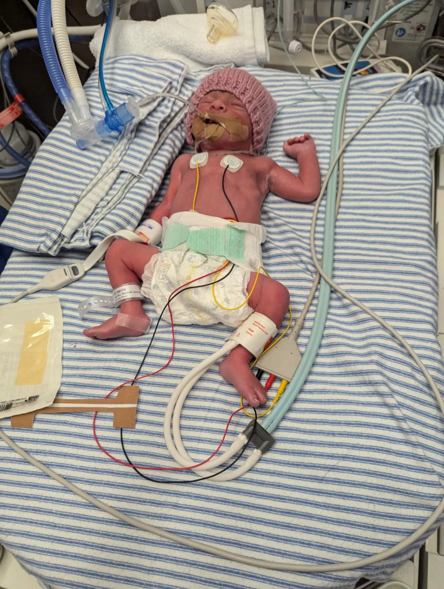 Baby Archie (pictured) as a newborn in hospital