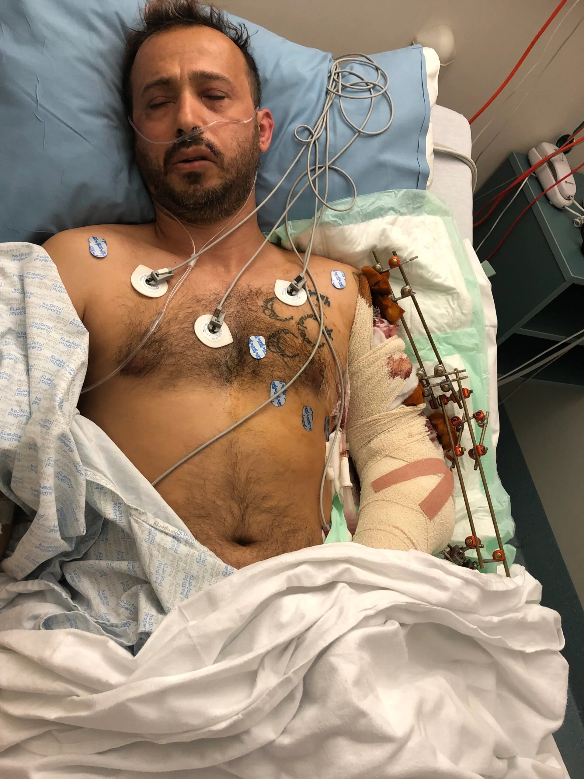 Image of attack victim recovering in hospital