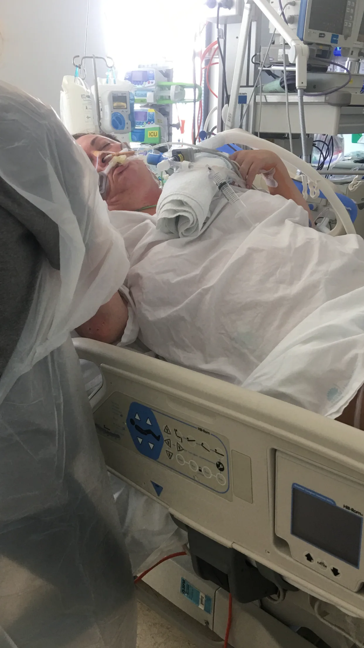 woman in hospital bed with tubes