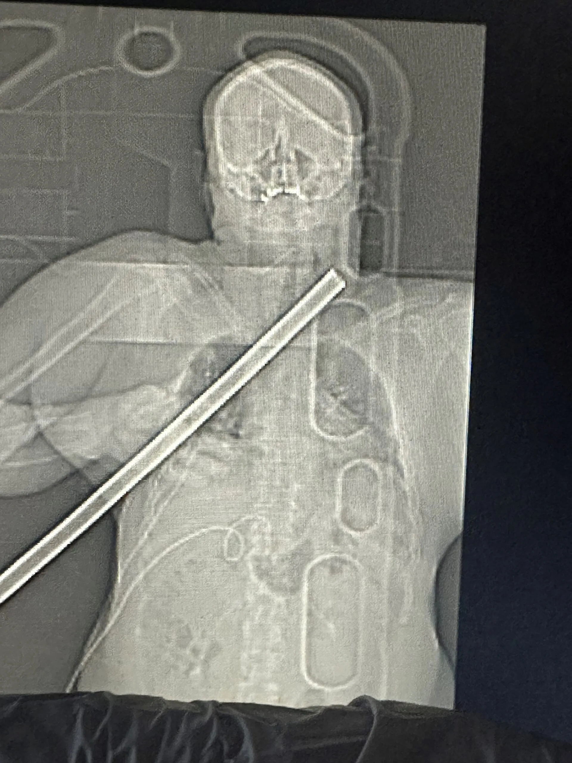 Xray of man impaled on a plumbing pipe