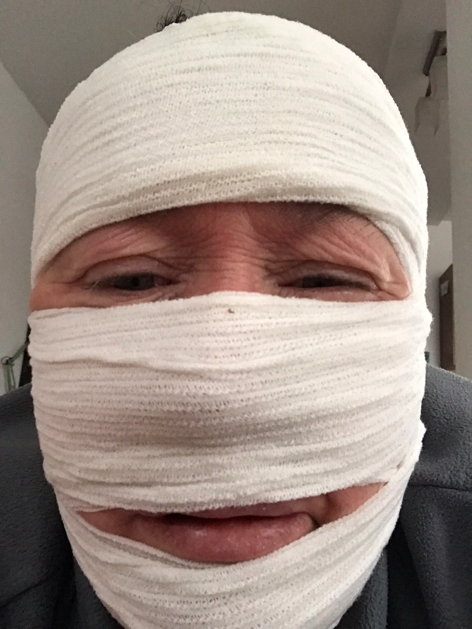 woman in bandages 