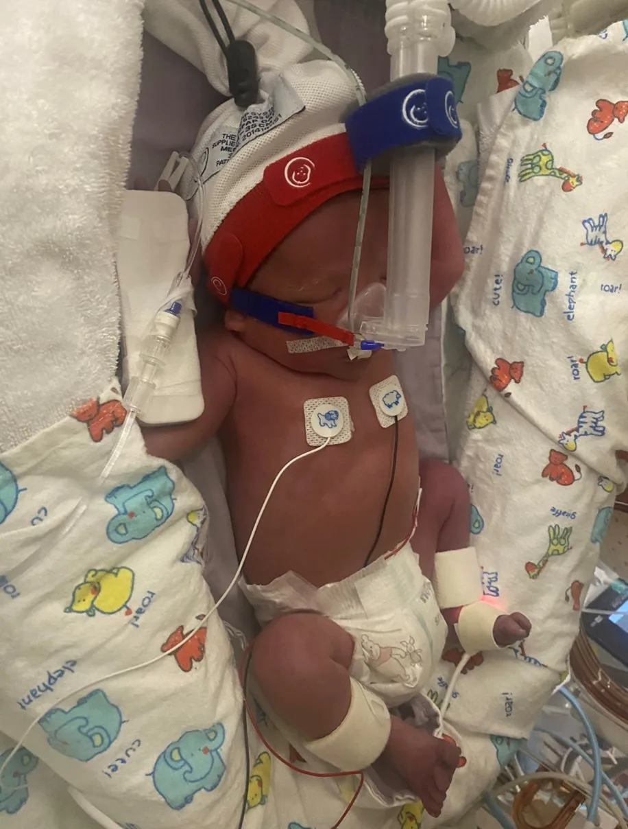 Baby Koa was born at just 32 weeks.