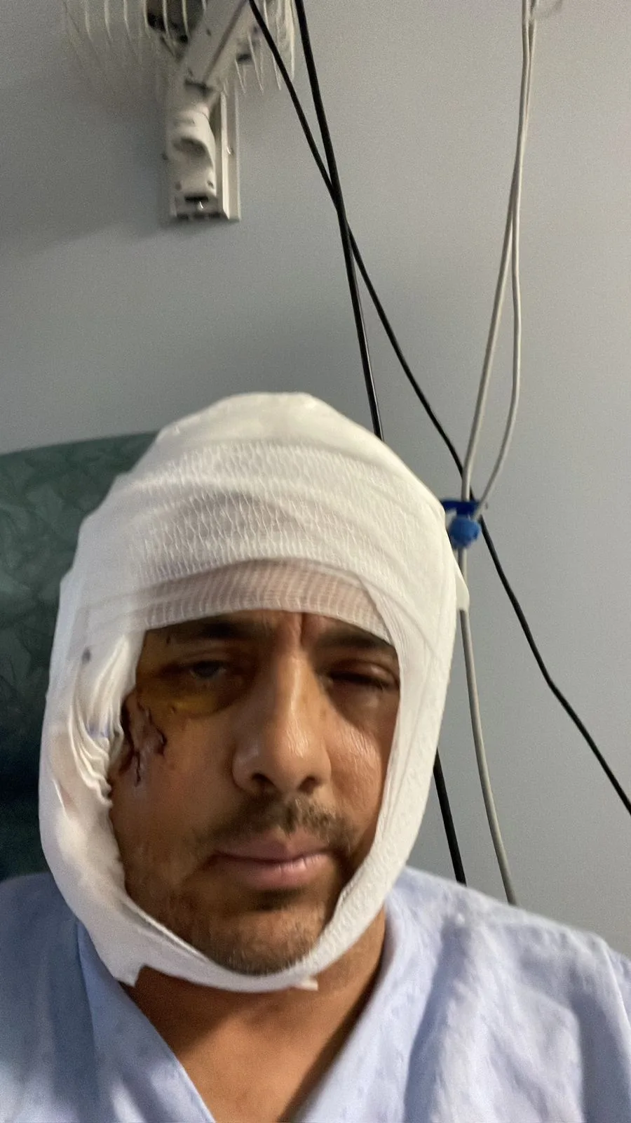 man with bandage on head