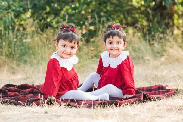 Mum’s shock: My sweet girls were born conjoined