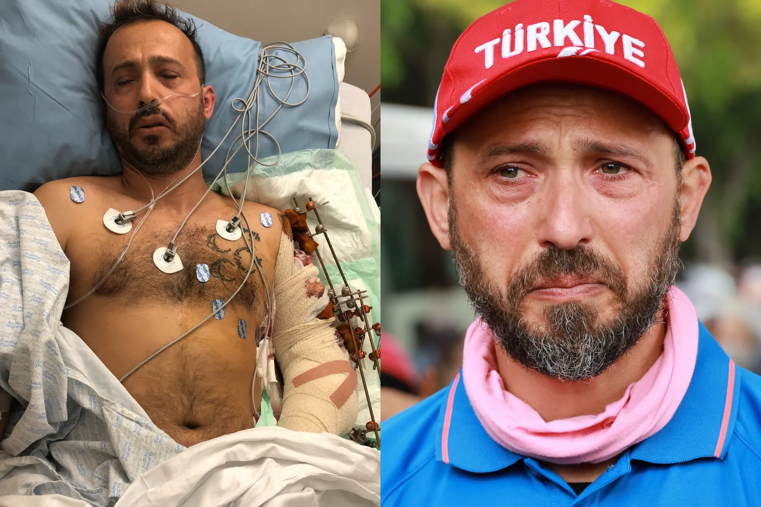 Left image - man recovering from attack in hospital Right image - attack survivor