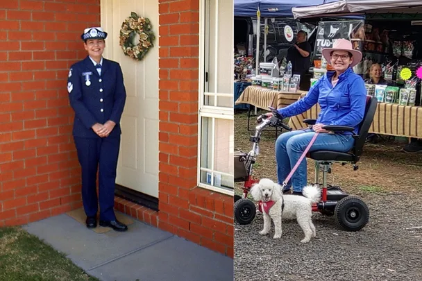 A rare condition is turning my body to stone