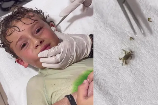 A crab was living in my boy’s ear