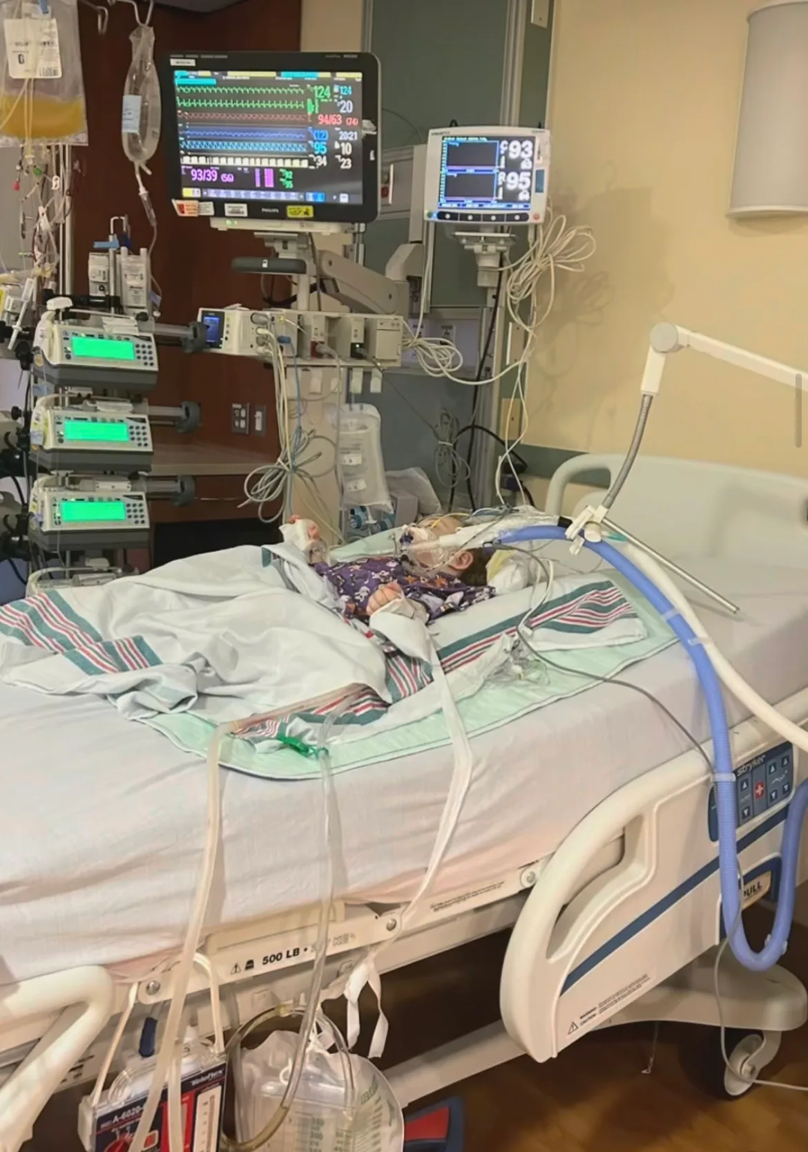 Newborn baby sleeping on hospital bed in blue pyjamas tied to multiple tubes and wires.