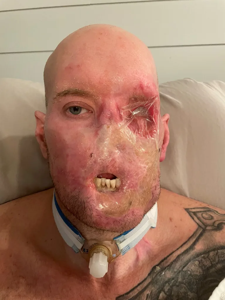 Image of man who was electrocuted at work