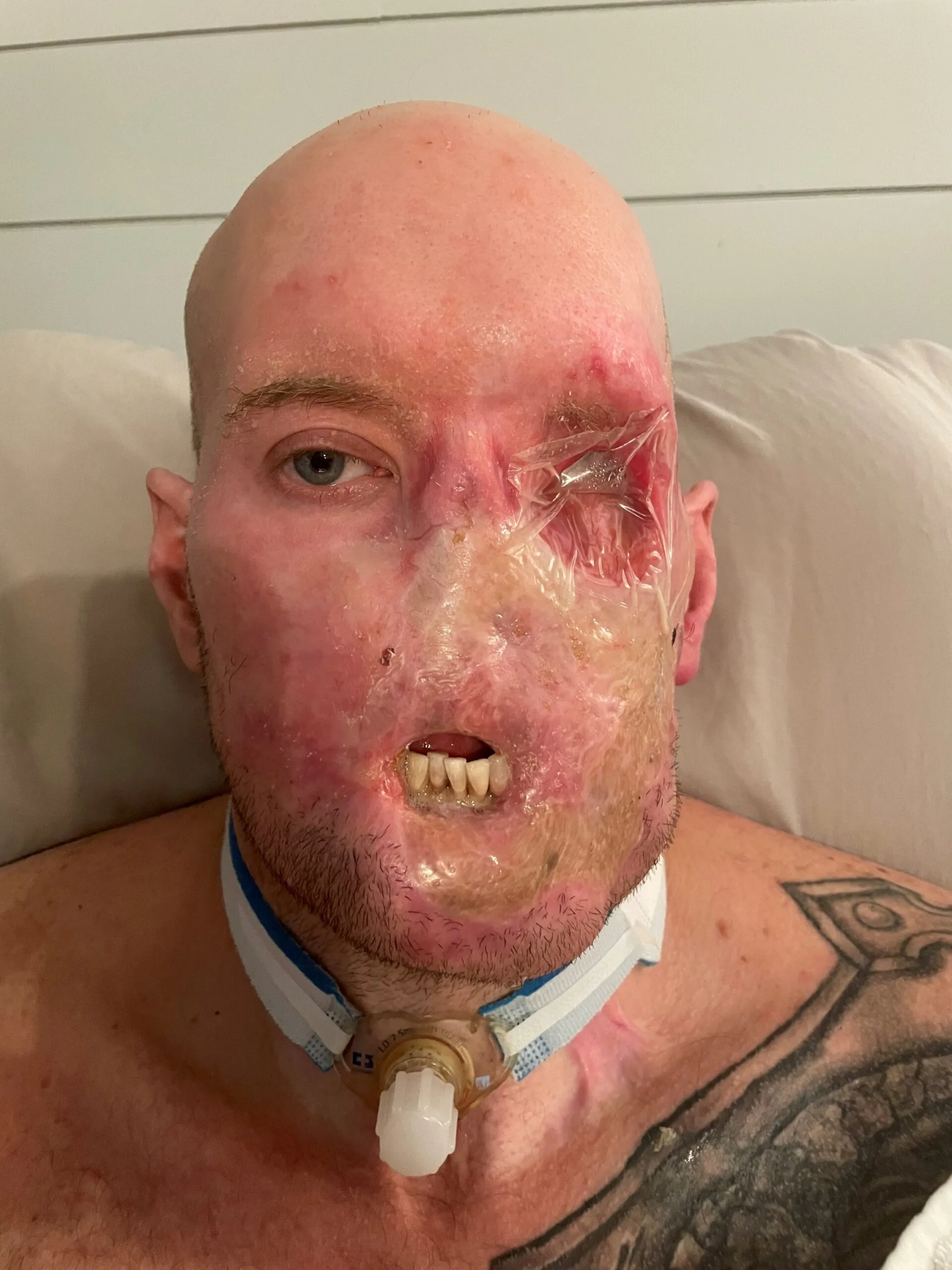 Image of man who was electrocuted at work