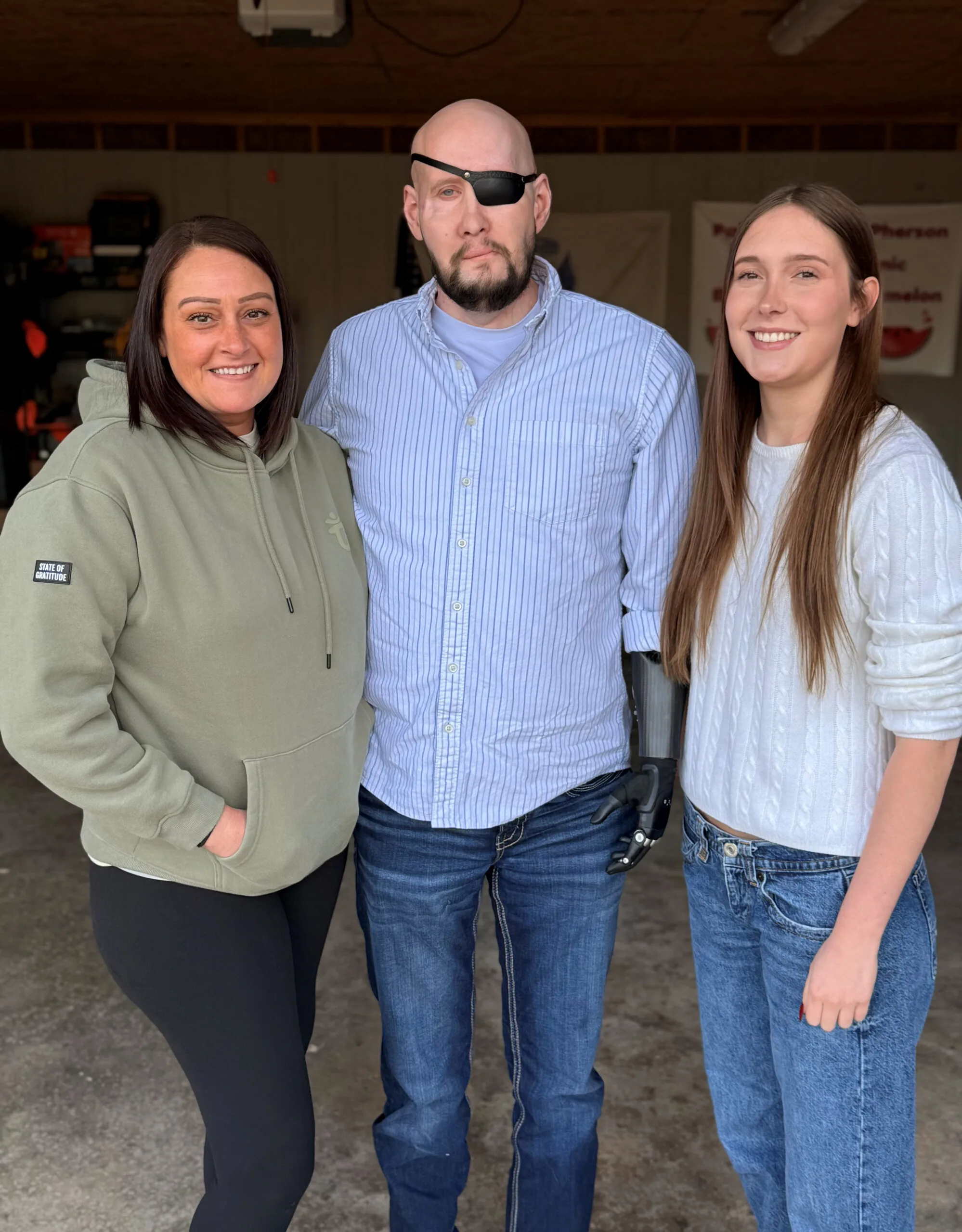 Image of wife, husband and their daughter after face transplant
