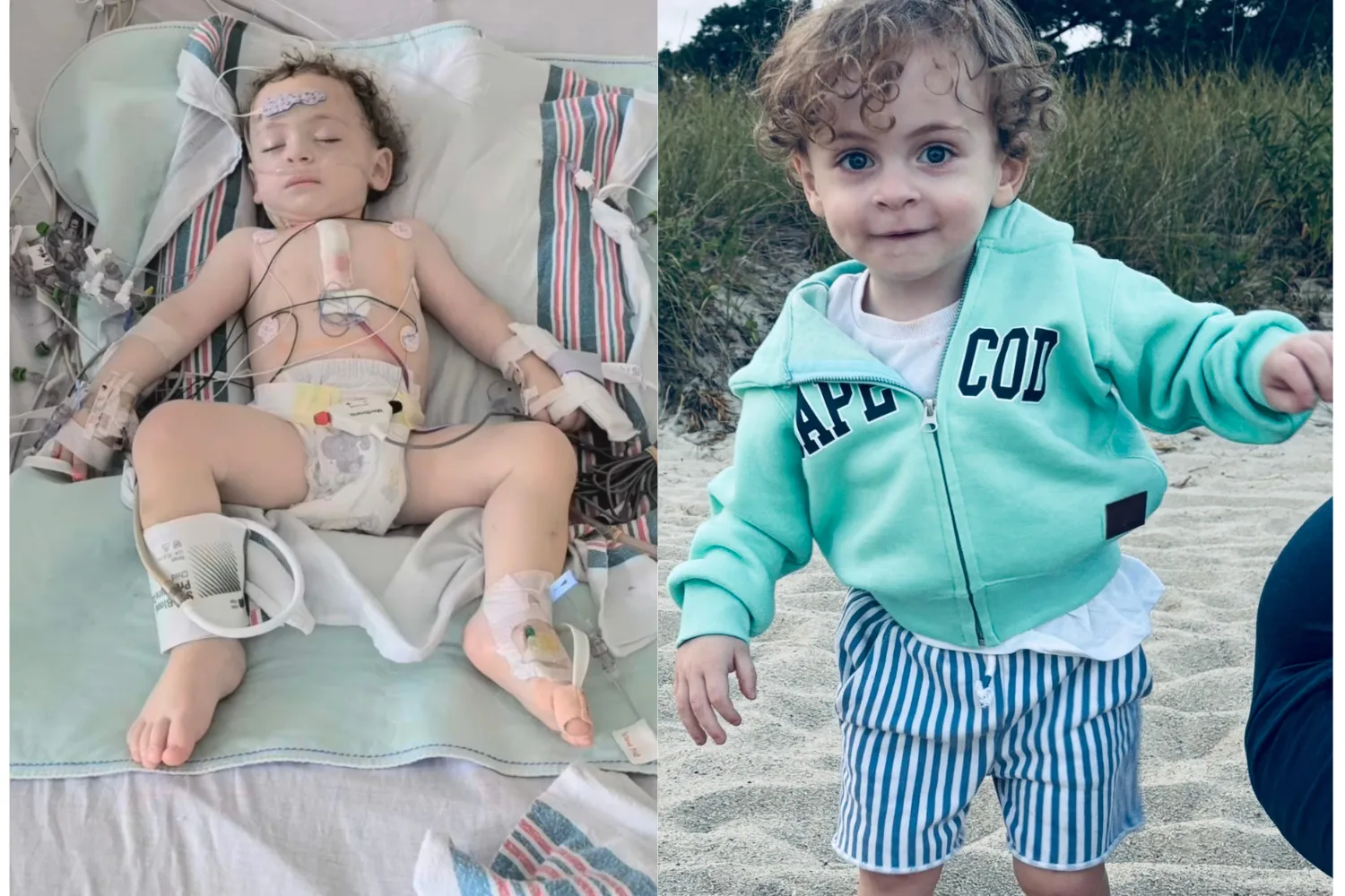 Left: Newborn baby laying on hospital bed, head resting on light blue towel, eyes closed while baby tied to multiple tubes and wires. Right: Toddler with blonde curls, wearing blue jacket standing on sand and smiling at camera.