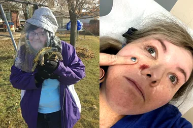 I’m allergic to the sun