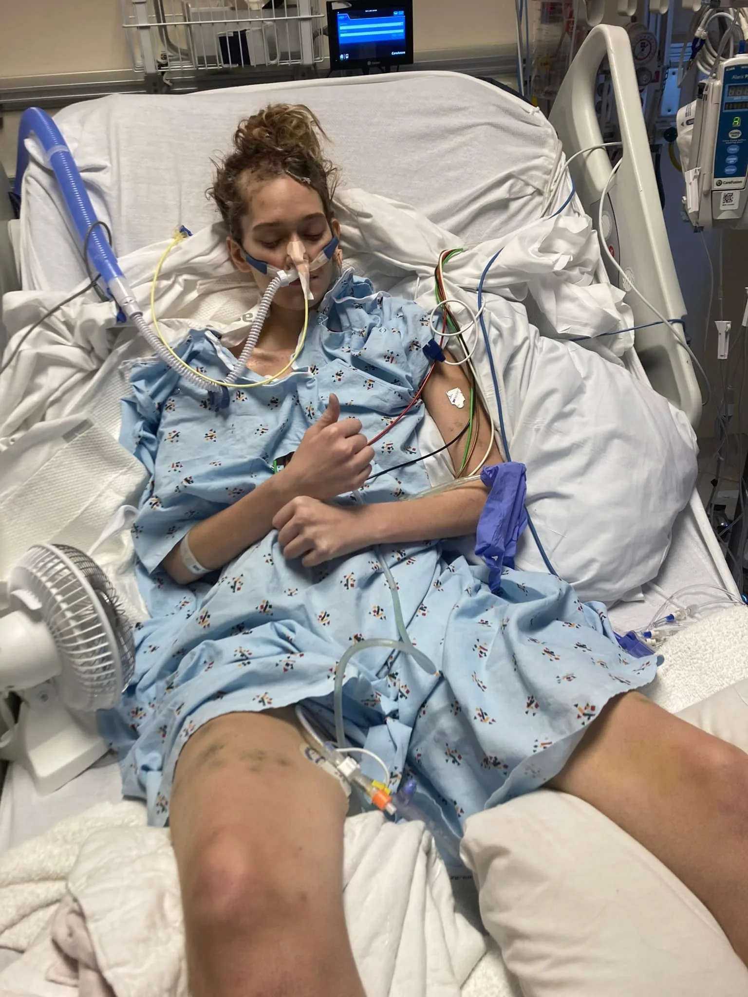 Image of woman in hospital