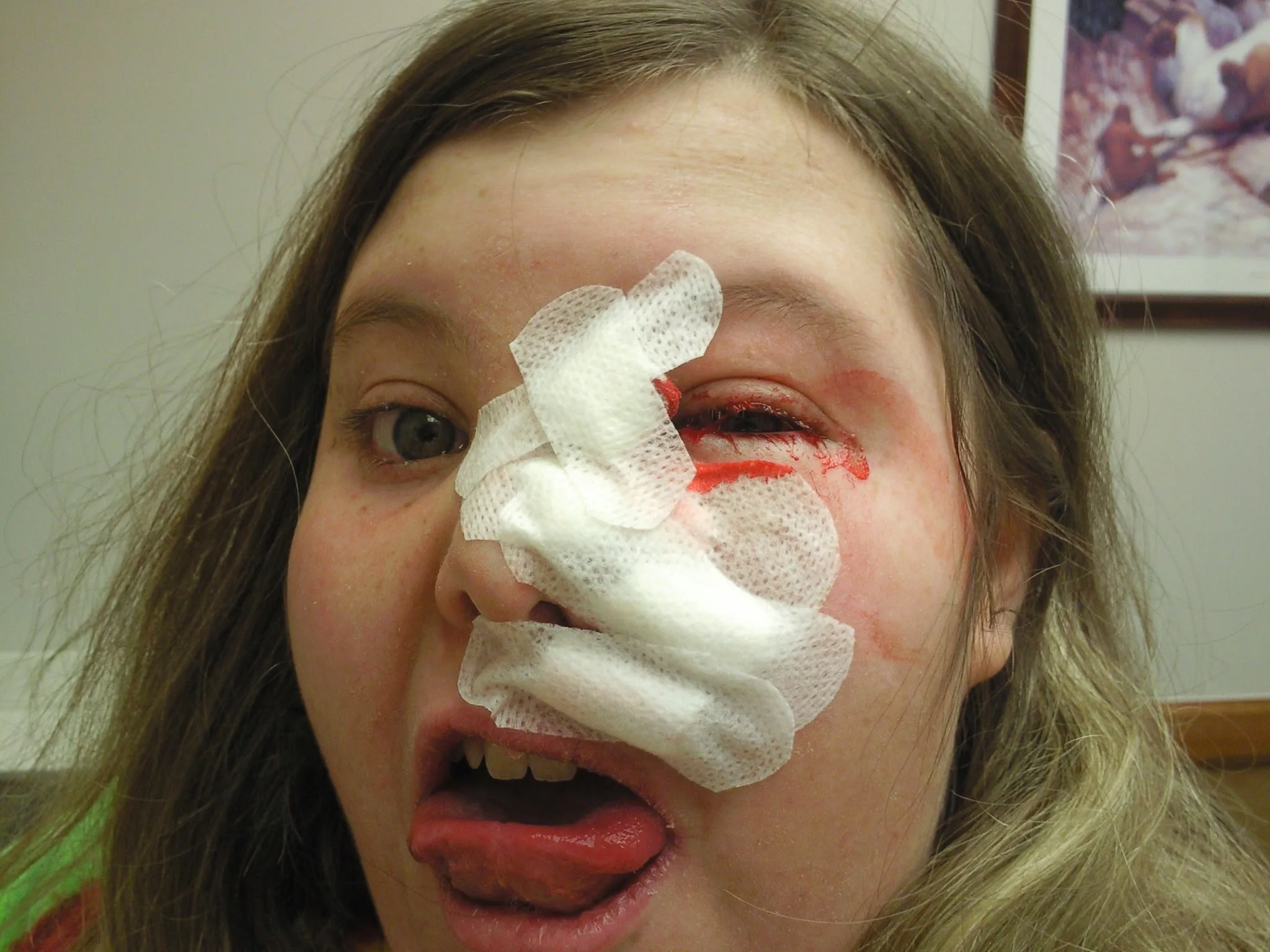 woman with bloody face bandage
