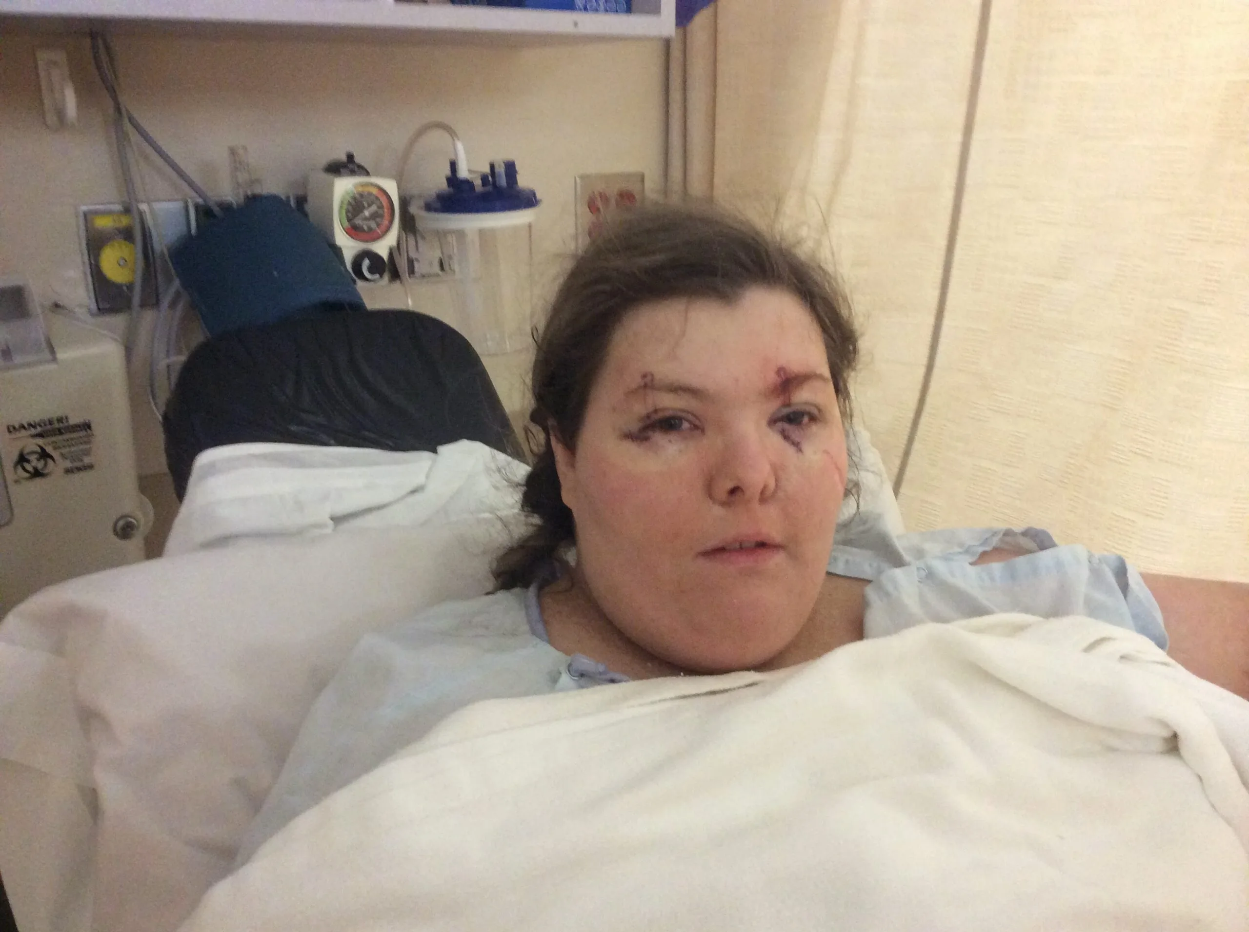 woman in hospital bed 
