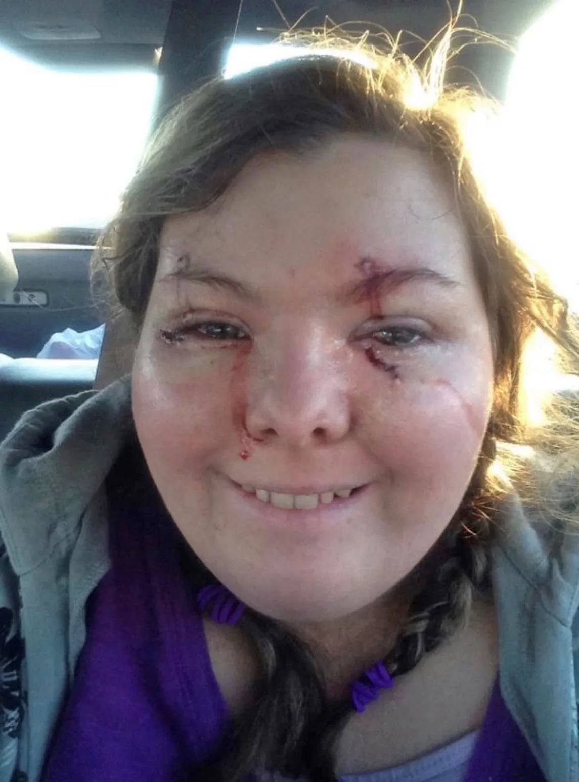 woman with bloody eyes